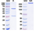 SDS-PAGE for Anti-Human F5/Factor V Antibody (SAA1769)