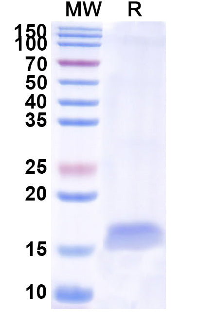 SDS-PAGE for Anti-Human CD49e/ITGA5 Nanobody (SAA1304)