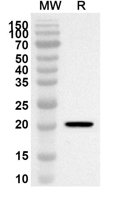 Western blot analysis was performed using anti-APRT polyclonal antibody at 1ug/mL on recombinant APRT (Catalog No. HY468012).