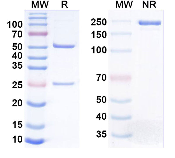 SDS-PAGE for Anti-Human IGFBP1 Monoclonal Antibody (1A111)