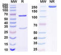 SDS-PAGE for Anti-Human IGFBP1 Monoclonal Antibody (1A413)