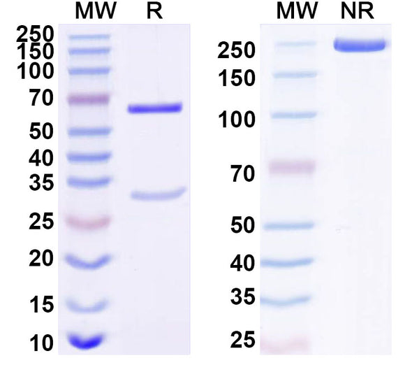 SDS-PAGE for Anti-Human IGFBP1 Monoclonal Antibody (1A413)
