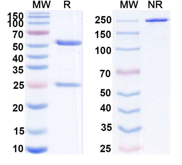 SDS-PAGE for InVivoMAb Anti-aPC/Activated protein C Antibody (Iv0267)