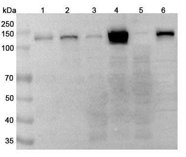 Western blot analysis was performed using anti-PARP1 polyclonal antibody at 1μg/ml on various samples.
Lane 1: Jurkat cell lysate
Lane 2: Hela cell lysate
Lane 3: HepG2 cell lysate
Lane 4: 293T cell lysate
Lane 5: A549 cell lysate
Lane 6: K562 cell lysate