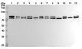 Western blot analysis was performed using anti-HSPA5 polyclonal antibody at 1ug/mL on various samples.
Lane 1: HepG2 cell lysate
Lane 2: NIH3T3 cell lysate
Lane 3: 4T1 cell lysate
Lane 4: MCF-7 cell lysate
Lane 5: Jurkat cell lysate
Lane 6: PC-12 cell lysate
Lane 7: Hela cell lysate
Lane 8: A549 cell lysate
Lane 9: Mouse brain lysate
Lane 10: Mouse liver lysate
Lane11: Rat brain lysate
Lane12: Rat  liver lysate