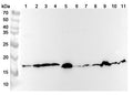 Western blot analysis was performed using anti-COX4I1 polyclonal antibody at 1ug/mL on various samples.
Lane 1: Hela cell lysate
Lane 2: Jurkat cell lysate
Lane 3: HepG2 cell lysate
Lane 4: MCF-7 cell lysate
Lane 5: Mouse heart lysate
Lane 6: Mouse skeletal muscle lysate
Lane 7: Mouse liver lysate
Lane 8: Mouse brain lysate
Lane 9: Rat heart lysate
Lane 10: Rat skeletal muscle lysate
Lane11: Rat liver lysate