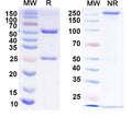 SDS-PAGE for Anti-Versican Antibody (N351/23)