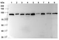 Western blot analysis was performed using anti-HSP90AA1 polyclonal antibody at 1µg/ml on various samples.
Lane 1: NIH3T3 cell lysate
Lane 2: PC-12 cell lysate
Lane 3: Hela cell lysate
Lane 4: MCF-7 cell lysate
Lane 5: Jurkat cell lysate
Lane 6: Lncap cell lysate
Lane 7: Raji cell lysate
Lane 8: Mouse brain lysate
Lane 9: Rat brain lysate