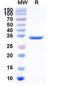 Recombinant Human CFH Protein, C-His