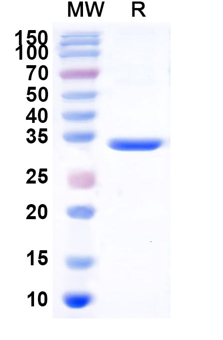 Recombinant Human CFH Protein, C-His