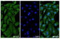 Hela cells were fixed with 4% paraformaldehyde for 20 minutes, followed by blocking with 5% goat serum for 1 hour. The cells were then incubated with a primary antibody targeting ALDOC (HY519014) at a concentration of 24 ug/ml overnight at 4°C. Afterward, the cells were incubated with a secondary antibody, Goat Anti-Rabbit IgG (Alexa Fluor-488) for 50 minutes at room temperature. The localization of ALDOC was visualized (shown in green), and nuclear DNA was stained with DAPI (shown in blue).