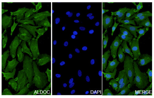 Hela cells were fixed with 4% paraformaldehyde for 20 minutes, followed by blocking with 5% goat serum for 1 hour. The cells were then incubated with a primary antibody targeting ALDOC (HY519014) at a concentration of 24 ug/ml overnight at 4°C. Afterward, the cells were incubated with a secondary antibody, Goat Anti-Rabbit IgG (Alexa Fluor-488) for 50 minutes at room temperature. The localization of ALDOC was visualized (shown in green), and nuclear DNA was stained with DAPI (shown in blue).