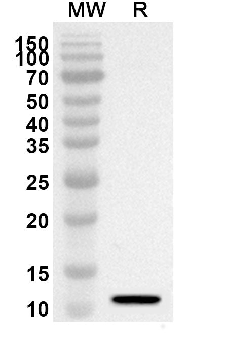 Western blot analysis was performed using anti-CXCL10/IP-10 polyclonal antibody at 1ug/mL on recombinant CXCL10/IP-10 (Catalog No. HY524012).
