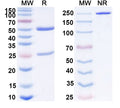 SDS-PAGE for Anti-Human CXCL10/IP-10 Antibody (SAA0413)
