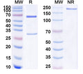 SDS-PAGE for Anti-Human ALPP/PLAP Antibody (SAA1786)