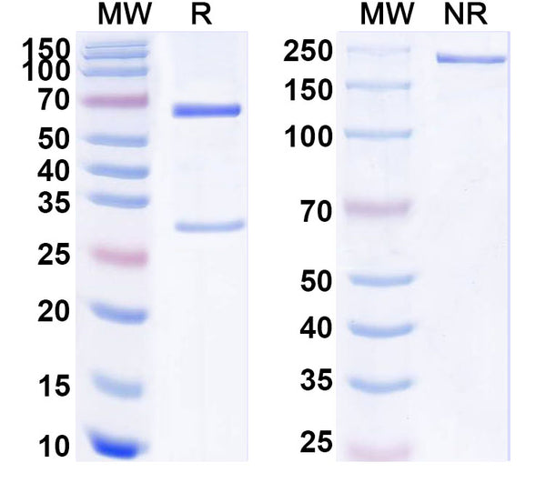 SDS-PAGE for Anti-Human ALPP/PLAP Antibody (SAA1786)