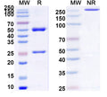 SDS-PAGE for Anti-Human ALPG/ALPPL2 Antibody (12F3).