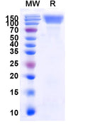 Recombinant Human CD66e/CEA/CEACAM5 Protein, C-His