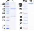 Anti-Human CEACAM-5/CD66e Reference Antibody (Cergutuzumab) – Figure 1 of 1