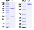 SDS-PAGE for Anti-Human CD66e/CEA/CEACAM5 Antibody (SAA2059).