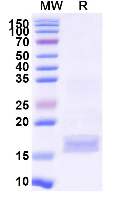 SDS-PAGE for Anti-Human CD66e/CEA/CEACAM5 Nanobody (C43)
