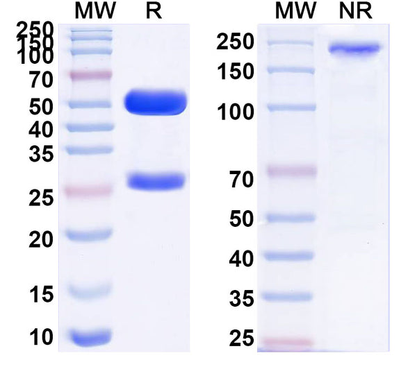 SDS-PAGE for Anti-Human CD66e/CEA/CEACAM5 Monoclonal Antibody (1A270)