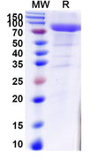 Recombinant Human KLKB1 Protein, C-His