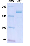 Anti-Human KLKB1/KLK3 Reference Antibody (Lanadelumab) – Figure 1 of 1