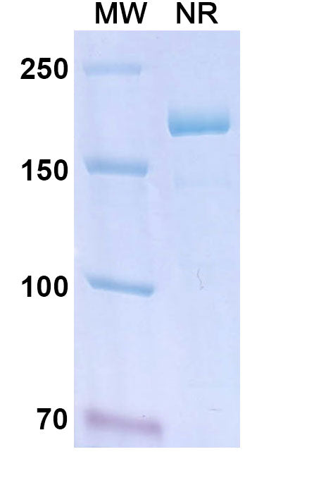 Anti-Human KLKB1/KLK3 Reference Antibody (Lanadelumab) – Figure 1 of 1
