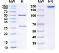 Anti-Human MYH6 Reference Antibody (Imciromab) – Figure 1 of 1