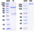 SDS-PAGE for Anti-Human CXCL1/NAP-3/GRO-alpha Antibody (SAA0462)