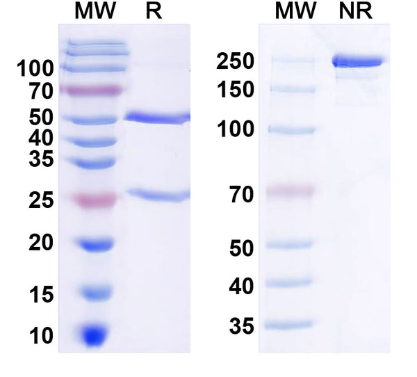 Flow-cytometry using anti-human IL8 antibody.IL8 Transfected CHO cells were stained with an irrelevant antibody (Blue Histogram) or an anti-human IL8 antibody monoclonal antibody (Catalog # HY554010 ,Green Histogram) at a concentration of 5 µg/ml for 30 mins at RT. After washing, bound antibody was detected using a FITC conjugated goat anti-mouse antibody (Catalog # MF690414) and cells analysed on a NovoCyte Flow Cytometer.