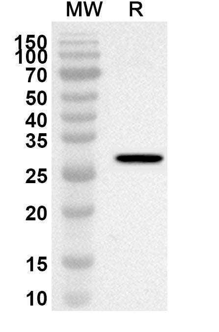 Western blot analysis was performed using anti-PIM1 polyclonal antibody at 1ug/mL on recombinant PIM1 (Catalog No. HY563012).