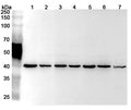 Western blot analysis was performed using anti-RPSA polyclonal antibody at 1μg/ml on various samples.
Lane 1: NIH3T3 cell lysate
Lane 2: Hela cell lysate
Lane 3: HepG2 cell lysate
Lane 4: Jurkat cell lysate
Lane 5: Raji cell lysate
Lane 6: A549 cell lysate
Lane 7: Mouse liver lysate