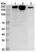 Western blot analysis was performed using anti-MYH7 polyclonal antibody at 1ug/mL on various samples.
Lane 1: Mouse heart lysate
Lane 2: Mouse skeletal muscle lysate
Lane 3: Rat skeletal muscle lysate