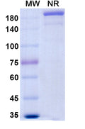 Anti-Human IL-6R alpha&IL6R Reference Antibody (Levilimab) – Figure 1 of 1