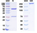 Anti-Human IL-6R alpha&IL6R Reference Antibody (Satralizumab) – Figure 1 of 2