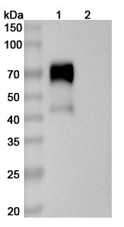 Flow-cytometry using anti-human CD126 antibody.CD126 Transfected CHO cells were stained with an irrelevant antibody (Blue Histogram) or an anti-human CD126 antibody monoclonal antibody (Catalog # HY583107 ,Green Histogram) at a concentration of 5 µg/ml for 30 mins at RT. After washing, bound antibody was detected using a FITC conjugated goat anti-mouse antibody (Catalog # MF690414) and cells analysed on a NovoCyte Flow Cytometer.