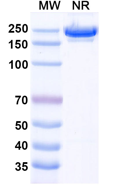 SDS-PAGE for Anti-Human CD126/IL6R/IL-6RA Antibody (SAA0049).