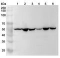 Western blot analysis was performed using anti-HARS1 polyclonal antibody at 1ug/mL on various samples.
Lane 1: Hela cell lysate
Lane 2: 293T cell  lysate
Lane 3: K562 cell lysate
Lane 4: HepG2 cell lysate
Lane 5: HCT116 cell  lysate
Lane 6: Jurkat cell lysate
