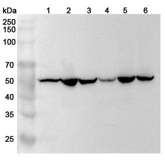 Western blot analysis was performed using anti-HARS1 polyclonal antibody at 1ug/mL on various samples.
Lane 1: Hela cell lysate
Lane 2: 293T cell  lysate
Lane 3: K562 cell lysate
Lane 4: HepG2 cell lysate
Lane 5: HCT116 cell  lysate
Lane 6: Jurkat cell lysate