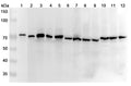Western blot analysis was performed using anti-DLAT polyclonal antibody at 1μg/ml on various samples.
Lane 1: Hela cell lysate
Lane 2: MCF-7 cell lysate
Lane 3: Lncap cell lysate
Lane 4: K562 cell lysate
Lane 5: HCT116 cell lysate
Lane 6: NIH3T3 cell lysate
Lane 7: Mouse brain lysate
Lane 8: Mouse liver lysate
Lane 9: Mouse kidney lysate
Lane 10: Rat brain lysate
Lane11: Rat liver lysate
Lane12: Rat kidney lysate