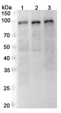 Western blot analysis was performed using anti-SP1 polyclonal antibody at 1μg/ml on various samples.
Lane 1: Jurkat cell lysate
Lane 2: K562 cell lysate
Lane 3: HepG2 cell lysate