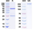 Anti-Human Integrin alpha 4 beta 7 Reference Antibody (Vedolizumab) – Figure 1 of 1