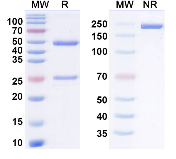 Anti-Human Complement Component C1s Reference Antibody (Claseprubart) – Figure 1 of 1