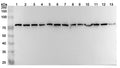 Western blot analysis was performed using anti-HSPA8 polyclonal antibody at 1ug/mL  on various samples.
Lane 1: 4T1 cell lysate
Lane 2: MCF-7 cell lysate
Lane 3: PC-12 cell lysate
Lane 4: NIH3T3 cell lysate
Lane 5: Hela cell lysate
Lane 6: U87 cell lysate
Lane 7: Jurkat cell lysate
Lane 8: HepG2 cell lysate
Lane 9: A549 cell lysate
Lane 10: Mouse brain lysate
Lane11: Mouse heart lysate
Lane12: Rat brain lysate
Lane13: Rat heart lysate