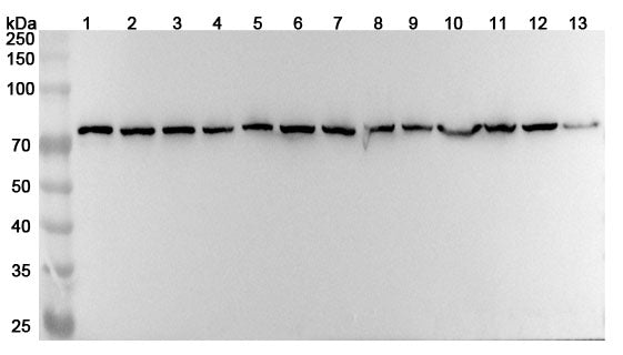 Western blot analysis was performed using anti-HSPA8 polyclonal antibody at 1ug/mL  on various samples.
Lane 1: 4T1 cell lysate
Lane 2: MCF-7 cell lysate
Lane 3: PC-12 cell lysate
Lane 4: NIH3T3 cell lysate
Lane 5: Hela cell lysate
Lane 6: U87 cell lysate
Lane 7: Jurkat cell lysate
Lane 8: HepG2 cell lysate
Lane 9: A549 cell lysate
Lane 10: Mouse brain lysate
Lane11: Mouse heart lysate
Lane12: Rat brain lysate
Lane13: Rat heart lysate