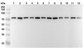 Western blot analysis was performed using anti-HSPA8 polyclonal antibody at 1µg/ml on various samples.
Lane 1: 4T1 cell lysate
Lane 2: MCF-7 cell lysate
Lane 3: PC-12 cell lysate
Lane 4: NIH3T3 cell lysate
Lane 5: Hela cell lysate
Lane 6: U87 cell lysate
Lane 7: Jurkat cell lysate
Lane 8: HepG2 cell lysate
Lane 9: A549 cell lysate
Lane 10: Mouse brain lysate
Lane11: Rat brain lysate
Lane12: Rat heart lysate