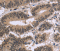 FAM107A Polyclonal Antibody – Figure 1 of 3