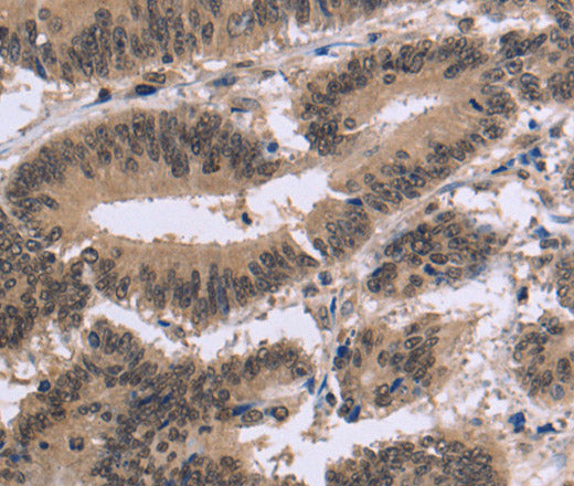 FAM107A Polyclonal Antibody – Figure 1 of 3